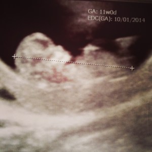 Bebe doit etre bien couvert